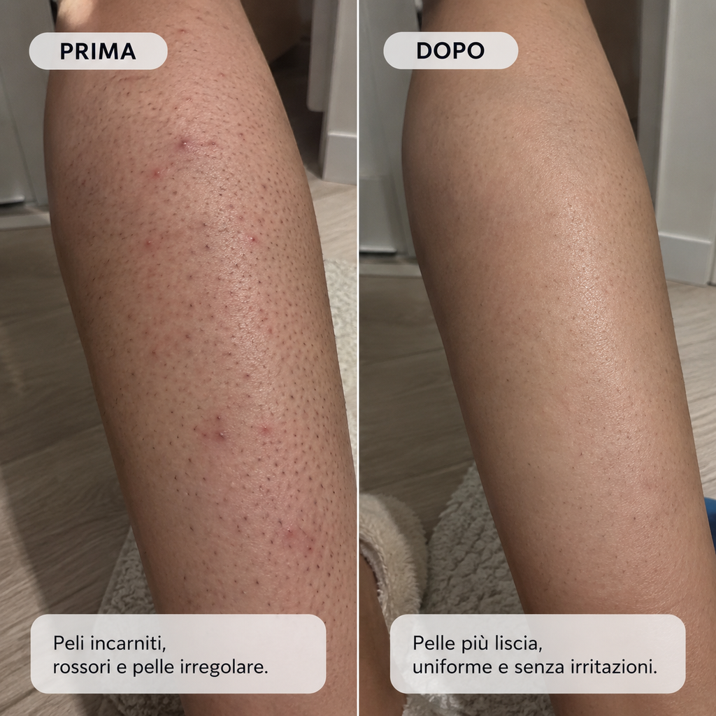 Anti Peli Incarniti & Levigante Post-Depilazione