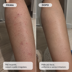 Anti Peli Incarniti & Levigante Post-Depilazione