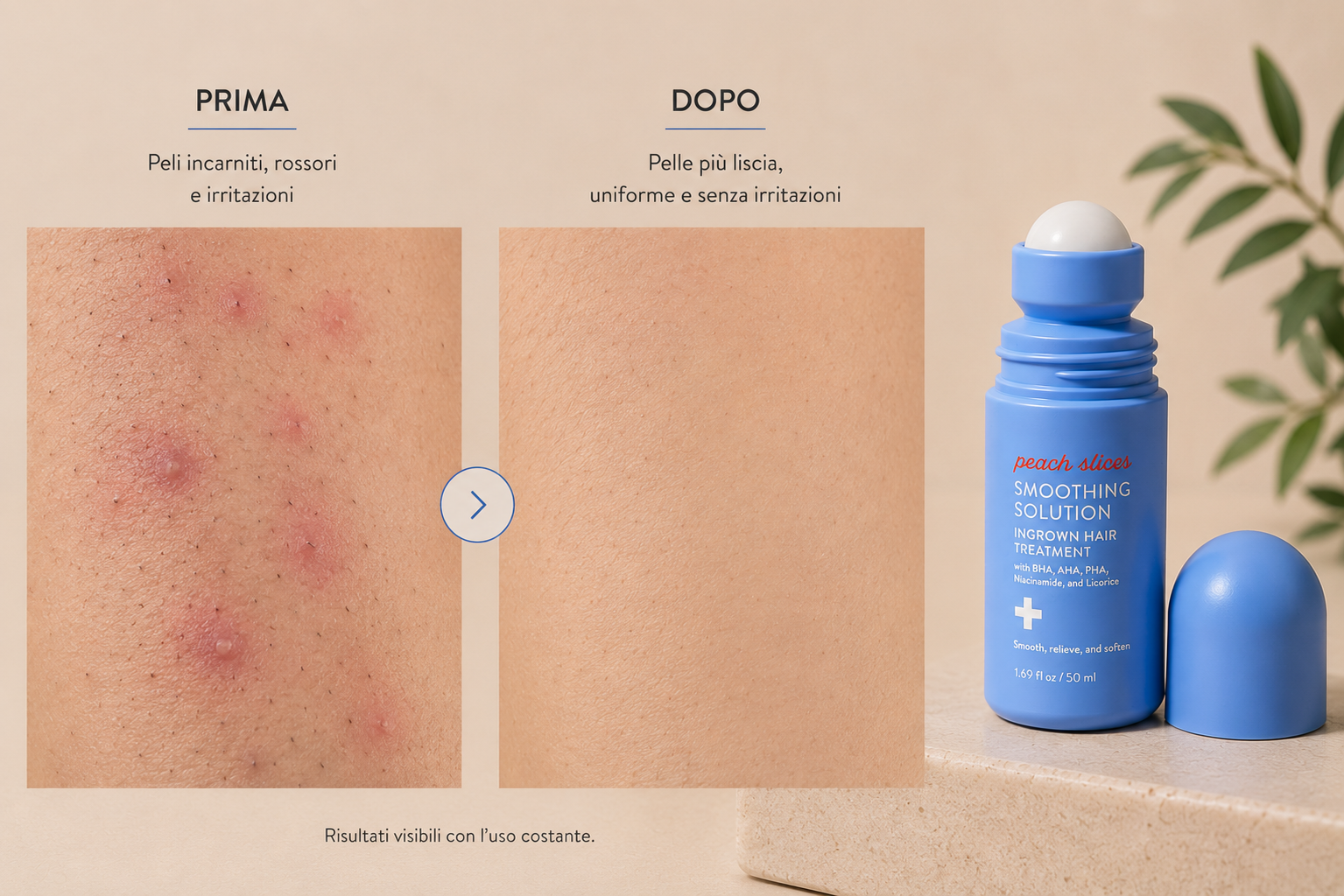 Anti Peli Incarniti & Levigante Post-Depilazione